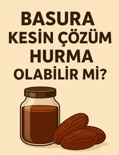 basura kesin çözüm hurma1